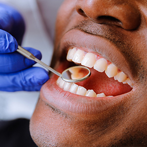 Best Dentist in Bronx